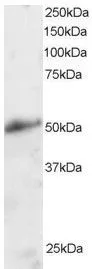 WB analysis of human kidney lysate using GTX22747 KLF8 antibody. Dilution : 2microg/ml Loading : 30microg protein in RIPA buffer