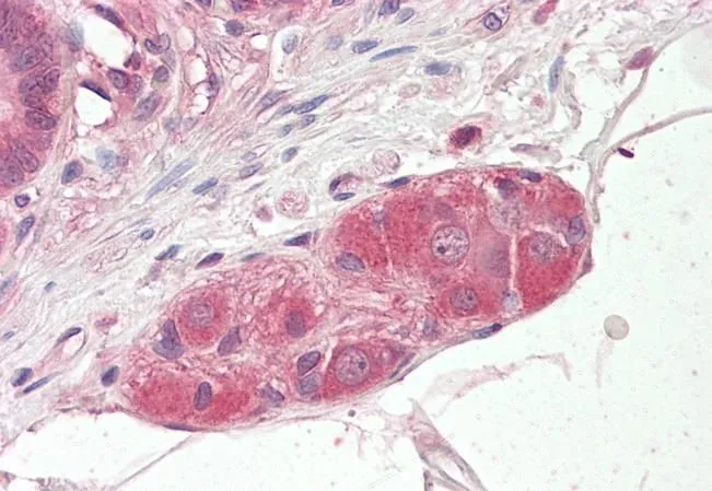 IHC-P analysis of human small intestine using GTX22747 KLF8 antibody. Antigen retrieval : citrate buffer pH 6 Dilution : 3.75microg/ml