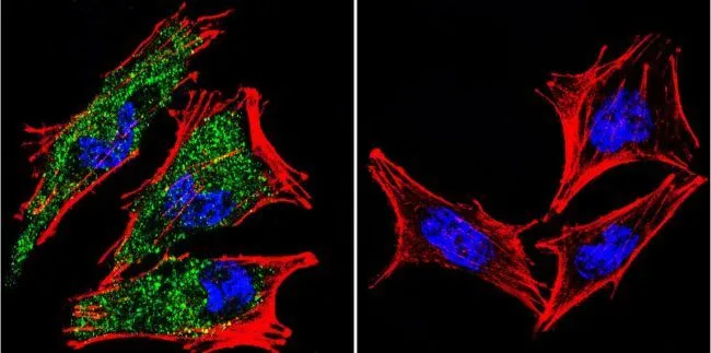 ICC/IF analysis of A2058 Cells using GTX22769 AHR antibody [RPT9]. Cells were probed without (right) or with(left) an antibody. Green : Primary antibody Blue : Nuclei Red : Actin Fixation : formaldehyde Dilution : 1:20 overnight at 4C