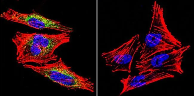 ICC/IF analysis of A2058 Cells using GTX22772 Prolactin Receptor antibody [U5]. Cells were probed without (right) or with(left) an antibody. Green : Primary antibody Blue : Nuclei Red : Actin Fixation : formaldehyde Dilution : 1:20 overnight at 4oC
