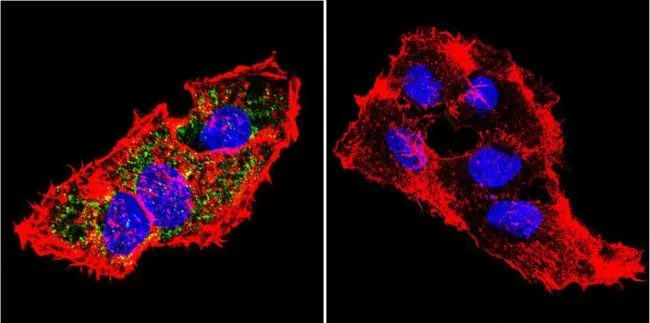 ICC/IF analysis of HepG2 cells using GTX22772 Prolactin Receptor antibody [U5]. Cells were probed without (right) or with(left) an antibody. Green : Primary antibody Blue : Nuclei Red : Actin Fixation : formaldehyde Dilution : 1:20 overnight at 4oC