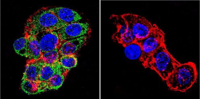 mineralocorticoid receptor antibody [h10e4c9f]