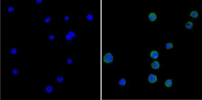 ICC/IF analysis of human cells using GTX22775 GRK1 antibody [G8]. Fixation : Formalin Permeabilization : 0.1% Triton X-100 in TBS for 5-10 minute Dilution : 1:100 incubated overnight in a humidified chamber