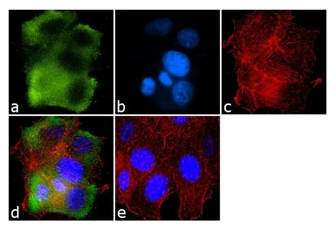 ICC/IF analysis of MCF-7 cells using GTX22775 GRK1 antibody [G8]. Panel e is a no primary antibody control. Green : Primary antibody Blue : Nuclei Red : Actin Fixation : 4% paraformaldehyde Permeabilization : 0.1% Triton X-100 for 10 minute Dilution : 2 microg/ml in 0.1% BSA and incubated for 3 hours at room temperature