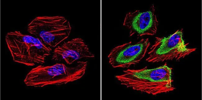 ICC/IF analysis of HeLa cells using GTX22775 GRK1 antibody [G8]. Cells were probed without (left) or with(right) an antibody. Green : Primary antibody Blue : Nuclei Red : Actin Fixation : Formalin Permeabilization : 0.1% Triton X-100 in TBS for 5-10 minute Dilution : 1:200 and incubated overnight in a humidified chamber