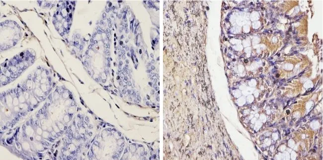 IHC-P analysis of mouse colon tissue using GTX22785 Galectin 3 antibody [A3A12]. Right : Primary antibody Left : Negative control without primary antibody Antigen retrieval : 10mM sodium citrate (pH 6.0) microwaved for 8-15 min Dilution : 1:20