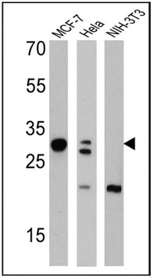 WB analysis of 25 ug of MCF-7 (Lane 1), Hela (Lane 2), and NIH-3T3 cell lysates (Lane 3) using GTX22785 Galectin 3 antibody [A3A12]. Dilution : 1:1000