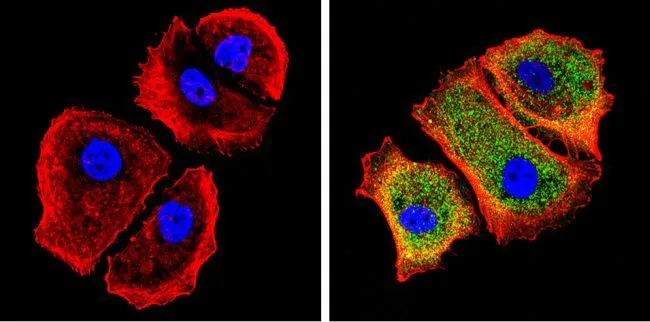 ICC/IF analysis of MCF-7 cells using GTX22785 Galectin 3 antibody [A3A12]. Cells were probed without (left) or with(right) an antibody. Green : Primary antibody Blue : Nuclei Red : Actin Fixation : Formalin Permeabilization : 0.1% Triton X-100 in TBS for 5-10 minute Dilution : 1:100 incubated overnight at 4 oC