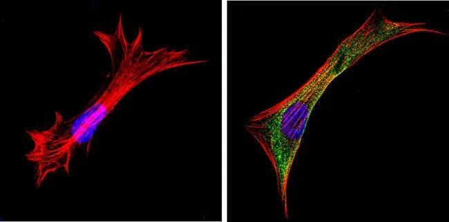 ICC/IF analysis of NIH-3T3 cells using GTX22785 Galectin 3 antibody [A3A12]. Cells were probed without (left) or with(right) an antibody. Green : Primary antibody Blue : Nuclei Red : Actin Fixation : Formalin Permeabilization : 0.1% Triton X-100 in TBS for 5-10 minute Dilution : 1:100 incubated overnight at 4 oC