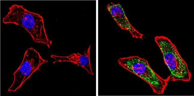ICC/IF analysis of HeLa cells using GTX22785 Galectin 3 antibody [A3A12]. Cells were probed without (left) or with(right) an antibody. Green : Primary antibody Blue : Nuclei Red : Actin Fixation : Formalin Permeabilization : 0.1% Triton X-100 in TBS for 5-10 minute Dilution : 1:100 incubated overnight at 4 oC