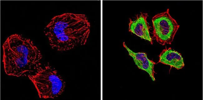 ICC/IF analysis of Hela cells using GTX22786 Endothelin 1 antibody [TR.ET.48.5]. Cells were probed without (left) or with(right) an antibody. Green : Primary antibody Blue : Nuclei Red : Actin Fixation : Formalin Permeabilization : 0.1% Triton X-100 in TBS for 5-10 minute Dilution : 1:200 incubated overnight at 4 oC