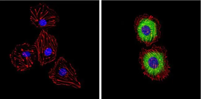 ICC/IF analysis of HUVEC cells using GTX22786 Endothelin 1 antibody [TR.ET.48.5]. Cells were probed without (left) or with(right) an antibody. Green : Primary antibody Blue : Nuclei Red : Actin Fixation : Formalin Permeabilization : 0.1% Triton X-100 in TBS for 5-10 minute Dilution : 1:200 incubated overnight at 4 oC