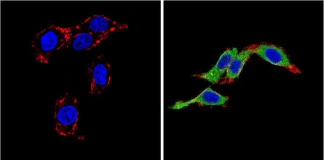 ICC/IF analysis of PC12 cells using GTX22786 Endothelin 1 antibody [TR.ET.48.5]. Cells were probed without (left) or with(right) an antibody. Green : Primary antibody Blue : Nuclei Red : Actin Fixation : Formalin Permeabilization : 0.1% Triton X-100 in TBS for 5-10 minute Dilution : 1:200 incubated overnight at 4 oC