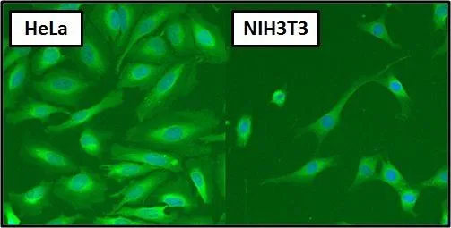 IHC-P analysis of human prostate carcinoma tissue using GTX22787 Hsp70 antibody [5A5].