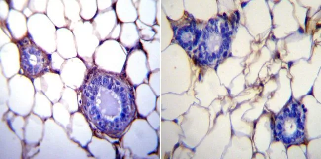 IHC-P analysis of mouse breast tissue using GTX22791 GRP94 antibody [9G10]. Right : Primary antibody Left : Negative control without primary antibody Antigen retrieval : heat induced antigen retrieval was performed using 10mM sodium citrate (pH6.0) buffer, microwaved for 8-15 minutes Dilution : 1:200