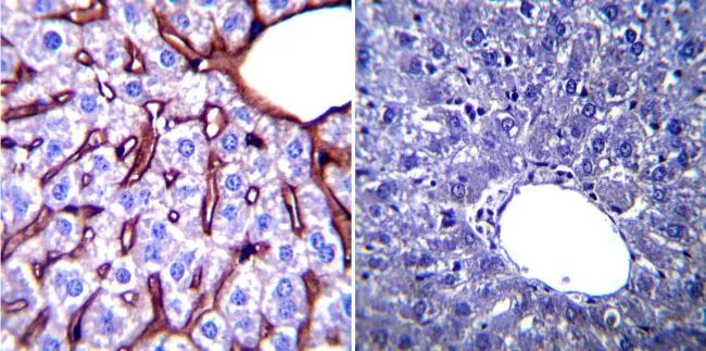 IHC-P analysis of mouse liver tissue using GTX22791 GRP94 antibody [9G10]. Left : Primary antibody Right : Negative control without primary antibody Antigen retrieval : heat induced antigen retrieval was performed using 10mM sodium citrate (pH6.0) buffer, microwaved for 8-15 minutes Dilution : 1:200