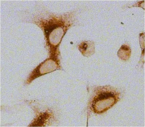 ICC/IF analysis of U2OS cells using GTX22791 GRP94 antibody [9G10]. Fixation : 4% paraformaldehyde Permeabilization : 0.1% Triton X-100 in PBS for 15 minutes Dilution : 1:100 for at least 1 hour at room temperature