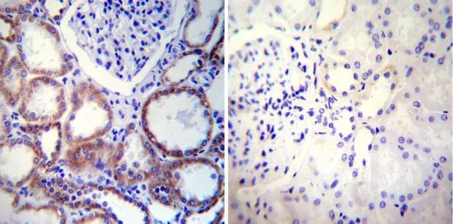 IHC-P analysis of human kidney tissue using GTX22798 Calnexin antibody [AF18]. Left : Primary antibody Right : Negative control without primary antibody Antigen retrieval : heat induced antigen retrieval was performed using 10mM sodium citrate (pH6.0) buffer, microwaved for 8-15 minutes Dilution : 1:50