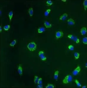 ICC/IF analysis of A549 cells using GTX22798 Calnexin antibody [AF18]. Green : Primary antibody Blue : Nuclei