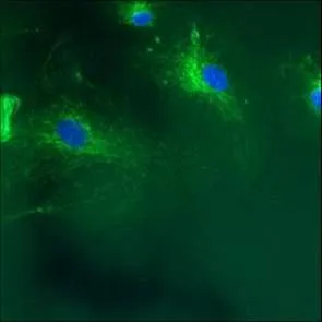 ICC/IF analysis of HMVEC Cells using GTX22798 Calnexin antibody [AF18]. Green : Primary antibody Blue : Nuclei