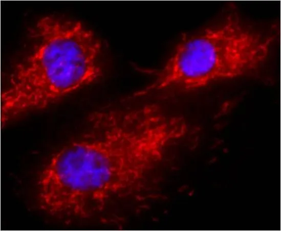ICC/IF analysis of U-87 MG cells using GTX22798 Calnexin antibody [AF18]. Red : Primary antibody Blue : Nuclei Fixation : 4% paraformaldehyde Permeabilization : 0.05% Triton X-100 in PBS for 60 seconds at room temperature Dilution : 1:100 for 2 hours at room temperature