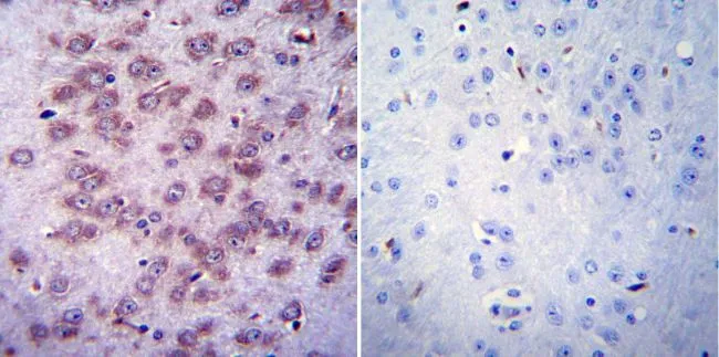 IHC-P analysis of mouse lymph node tissue using GTX22804 AChR antibody [88B].