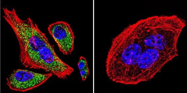 ICC/IF analysis of A549 cells using GTX22817 SERCA2 ATPase antibody [IID8].Cells were probed without (right) or with(left) an antibody. Green : Primary antibody Blue : Nuclei Red : Actin Fixation : formaldehyde Dilution : 1:200 overnight at 4?