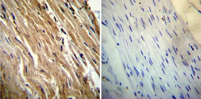 IHC-P analysis of human heart tissue using GTX22824 Calsequestrin antibody [VIIID12]. Left : Primary antibody Right : Negative control without primary antibody Antigen retrieval : heat induced antigen retrieval was performed using 10mM sodium citrate (pH6.0) buffer, microwaved for 8-15 minutes Dilution : 1:200
