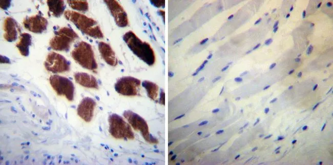 IHC-P analysis of human skeletal muscle tissue using GTX22824 Calsequestrin antibody [VIIID12]. Left : Primary antibody Right : Negative control without primary antibody Antigen retrieval : heat induced antigen retrieval was performed using 10mM sodium citrate (pH6.0) buffer, microwaved for 8-15 minutes Dilution : 1:20