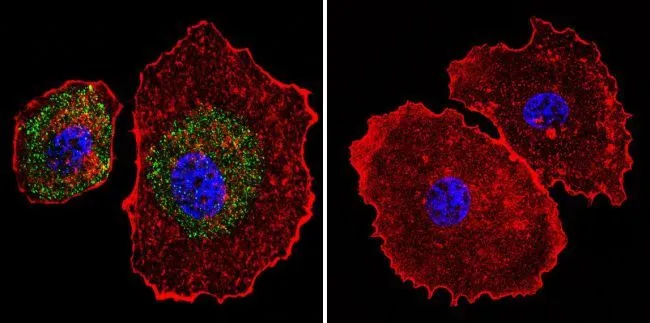 ICC/IF analysis of MCF-7 cells using GTX22824 Calsequestrin antibody [VIIID12]. Cells were probed without (right) or with(left) an antibody. Green : Primary antibody Blue : Nuclei Red : Actin Fixation : formaldehyde Dilution : 1:100 overnight at 4 oC