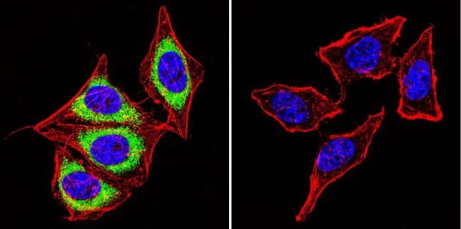 ICC/IF analysis of HeLa cells using GTX22824 Calsequestrin antibody [VIIID12]. Cells were probed without (right) or with(left) an antibody. Green : Primary antibody Blue : Nuclei Red : Actin Fixation : formaldehyde Dilution : 1:100 overnight at 4 oC