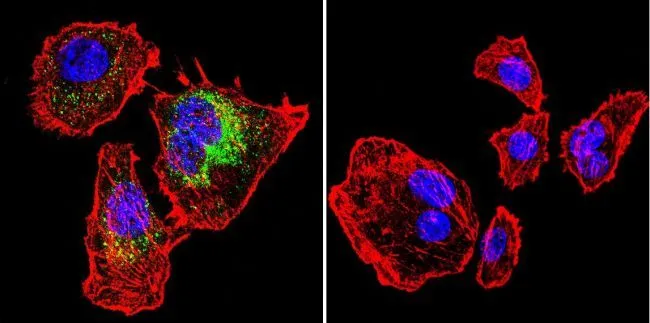ICC/IF analysis of U251 cells using GTX22824 Calsequestrin antibody [VIIID12]. Cells were probed without (right) or with(left) an antibody. Green : Primary antibody Blue : Nuclei Red : Actin Fixation : formaldehyde Dilution : 1:100 overnight at 4 oC