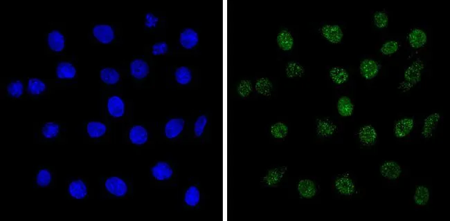 ICC/IF analysis of C6 cells using GTX22828 MECP2 antibody. Cells were probed without (left) or with(right) an antibody.