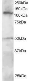 WB analysis of Jurkat lysate using GTX22835 HLTF antibody. Dilution : 0.5microg/ml Loading : 30microg protein in RIPA buffer