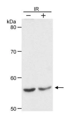 WB analysis of HeLa cells treated with 10 Gy ionizing radiation (IR) or untreated using GTX22845 Chk1 antibody. Dilution : 0.1 microg/ml