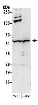 WB analysis of Jurkat and 293T cell lysate (in NETN lysis buffer) using GTX22845 Chk1 antibody. Dilution : 0.4 microg/ml