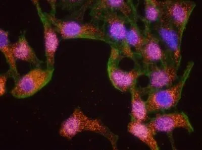 PLA analysis of HeLa cells using GTX22845 Chk1 antibody and anti-human PCNA antibody. Green : Actin Red : positive signal Blue : DAPI