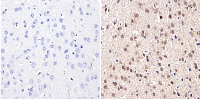 IHC-P analysis of mouse brain tissue using GTX22851 DNMT3B antibody. Right : Primary antibody Left : Negative control without primary antibody Antigen retrieval : 10mM sodium citrate (pH 6.0) microwaved for 8-15 min Dilution : 1:200