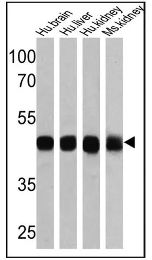 WB analysis of 25 ug of human brain (lane 1),human liver (lane 2),human kidney (lane 3) and mouse kidney (lane 4) lysates using GTX22873 Sodium/Potassium ATPase beta 1 antibody [M17-P5-F11]. Dilution : 1:5000
