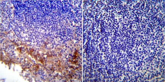 IHC-P analysis of mouse lymph node tissue using GTX22898 KDEL antibody. Left : Primary antibody Right : Negative control without primary antibody Antigen retrieval : heat induced antigen retrieval was performed using 10mM sodium citrate (pH6.0) buffer, microwaved for 8-15 minutes Dilution : 1:200