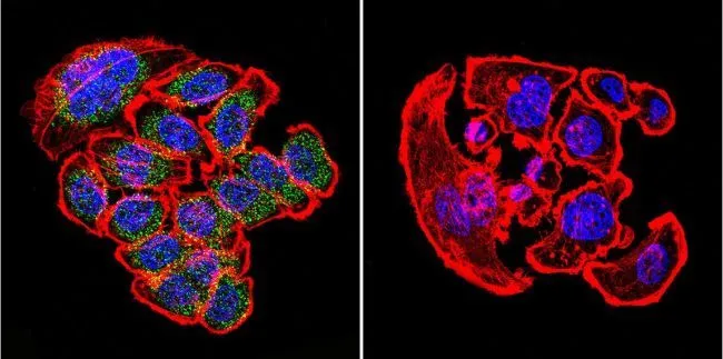 ICC/IF analysis of U251 cells using GTX22898 KDEL antibody. Cells were probed without (right) or with(left) an antibody. Green : Primary antibody Blue : Nuclei Red : Actin Fixation : formaldehyde Dilution : 1:200 overnight at 4oC