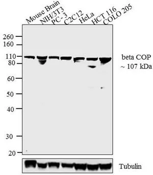 WB analysis of rat brain homogenate using GTX22899 COPB antibody.