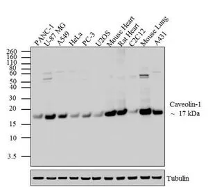 WB analysis of whole cell extracts (20 microg lysate) of PANC-1 (Lane 1), U-87 MG (Lane 2), A549 (Lane 3), HeLa (lane4), PC-3 (lane 5), U2OS (lane 6), Mouse Heart (lane 7), Rat Heart (lane 8), C2C12 (lane 9), Mouse Lung (lane 10) and A-431 (lane 11) using GTX22910 Caveolin 1 antibody. Dilution : 1-2 microg/ml