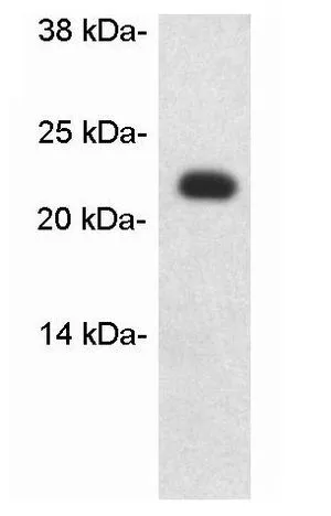 WB analysis of rat heart protein extract using GTX22910 Caveolin 1 antibody.