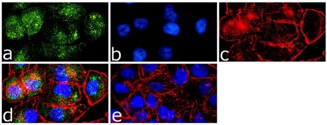 ICC/IF analysis of A375 cells using GTX22910 Caveolin 1 antibody. Panel e is a no primary antibody control. Green : Primary antibody Blue : Nuclei Red : Actin Fixation : 4% paraformaldehyde Permeabilization : 0.25% Triton X-100 for 10 minutes Dilution : 1 microg/ml in 1% BSA and incubated for 3 hours at room temperature