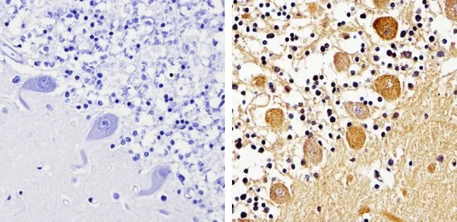IHC-P analysis of human cerebellum tissue using GTX22914 pan Arrestin antibody. Right : Primary antibody Left : Negative control without primary antibody Antigen retrieval : 10mM sodium citrate (pH 6.0), microwaved for 8-15 min Dilution : 1:500 IHC-P analysis of human cerebellum tissue using GTX22914 pan Arrestin antibody. Right : Primary antibody Left : Negative control without primary antibody Antigen retrieval : 10mM sodium citrate (pH 6.0), microwaved for 8-15 min Dilution : 1:500