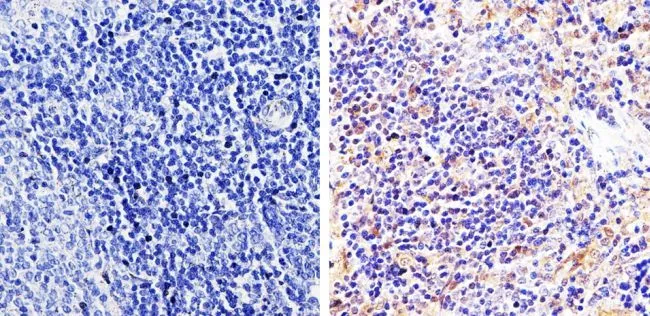 IHC-P analysis of rat spleen tissue using GTX22914 pan Arrestin antibody. Right : Primary antibody Left : Negative control without primary antibody Antigen retrieval : 10mM sodium citrate (pH 6.0), microwaved for 8-15 min Dilution : 1:500