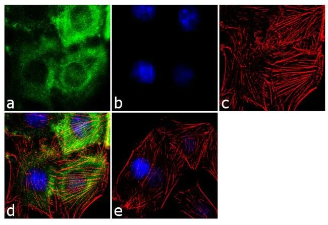 ICC/IF analysis of L6 cells using GTX22915 COPB antibody. Panel e is a no primary antibody control. Green : Primary antibody Blue : Nuclei Red : Actin Fixation : 4% paraformaldehyde Permeabilization : 0.1% Triton X-100 for 10 minute Dilution : 2 microg/ml in 0.1% BSA incubated for 3 hours at room temperature