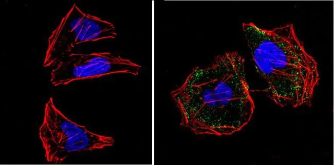 ICC/IF analysis of Hela cells using GTX22922 RASA1 antibody [B4F8]. Cells were probed without (left) or with(right) an antibody.