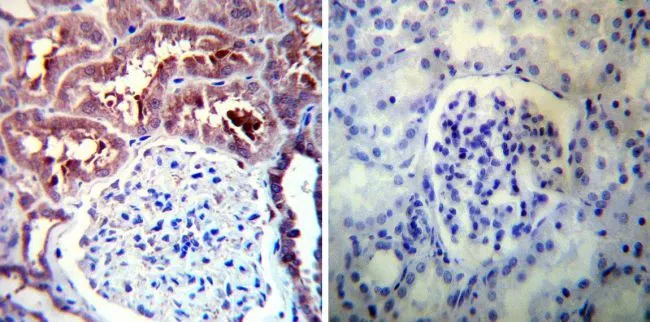 IHC-P analysis of human kidney tissue using GTX22928 Hsp90 alpha antibody. Left : Primary antibody Right : Negative control without primary antibody Antigen retrieval : heat induced antigen retrieval was performed using 10mM sodium citrate (pH6.0) buffer, microwaved for 8-15 minutes Dilution : 1:100